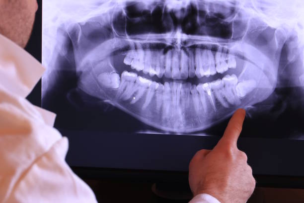 Best Weekend Emergency Dentist in Fort Valley, GA
