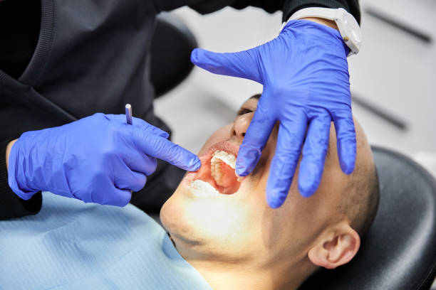 Best Emergency Broken Tooth Repair in Fort Valley, GA
