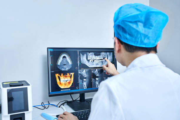 Best Emergency Tooth Extraction in Fort Valley, GA