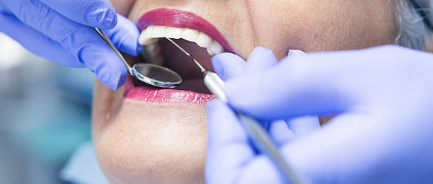 Best Emergency Treatment for Toothache in Fort Valley, GA
